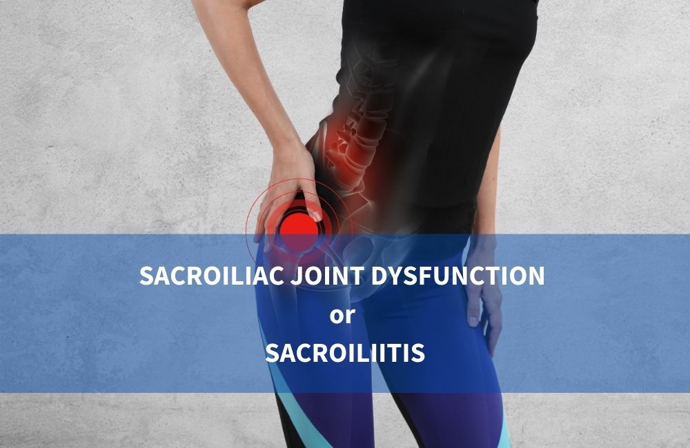 Where is SI Joint Pain Felt and How to Recognize it