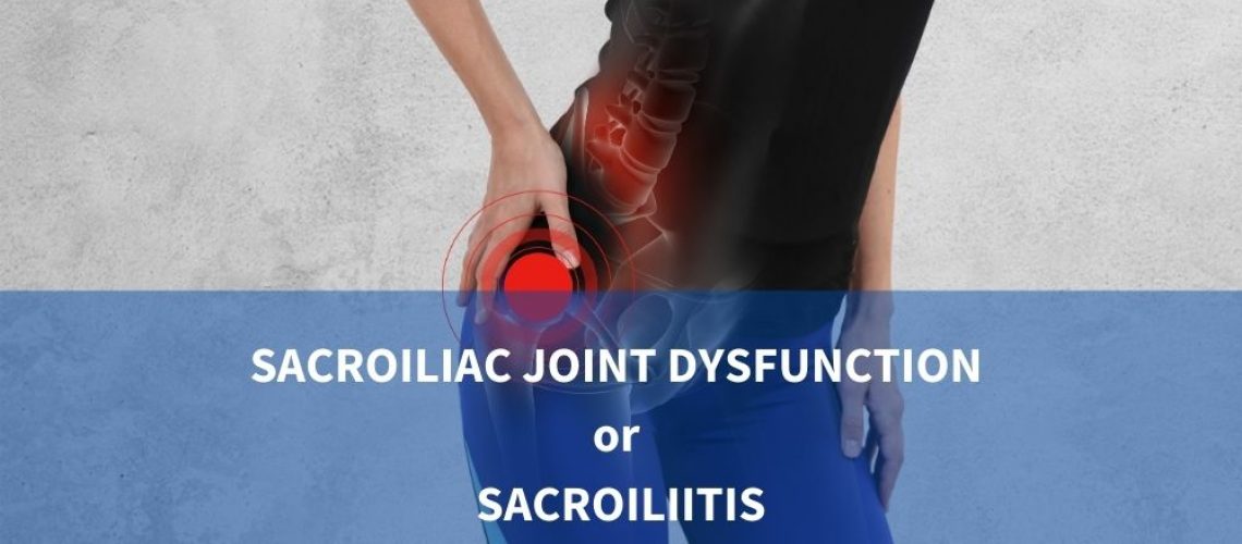 Sacroiliac Joint Dysfunction Or Sacroiliitis: Symptoms, Causes ...